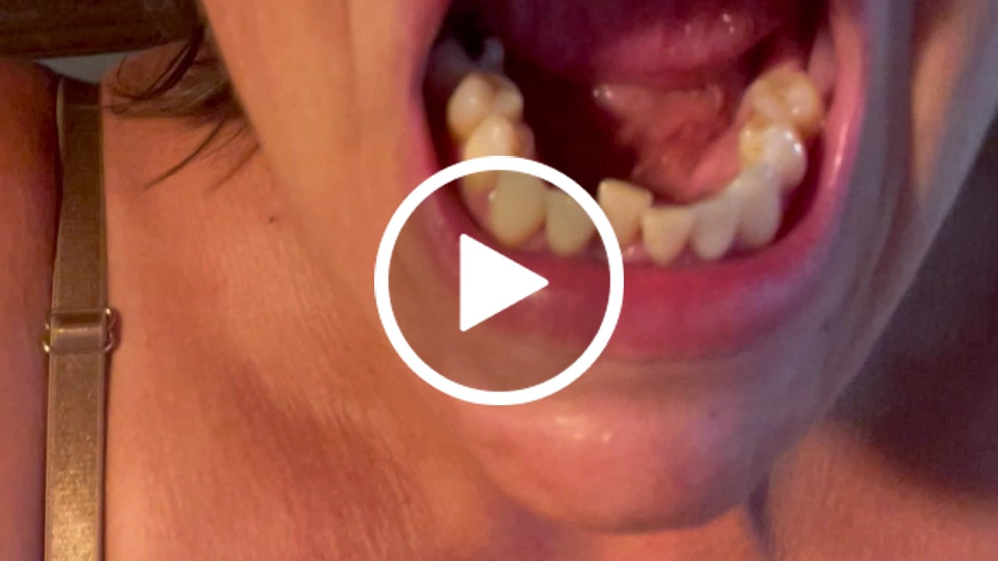 Customer video review of PerioSafe tandpasta med MicroSilver, 75ml, 1 stk