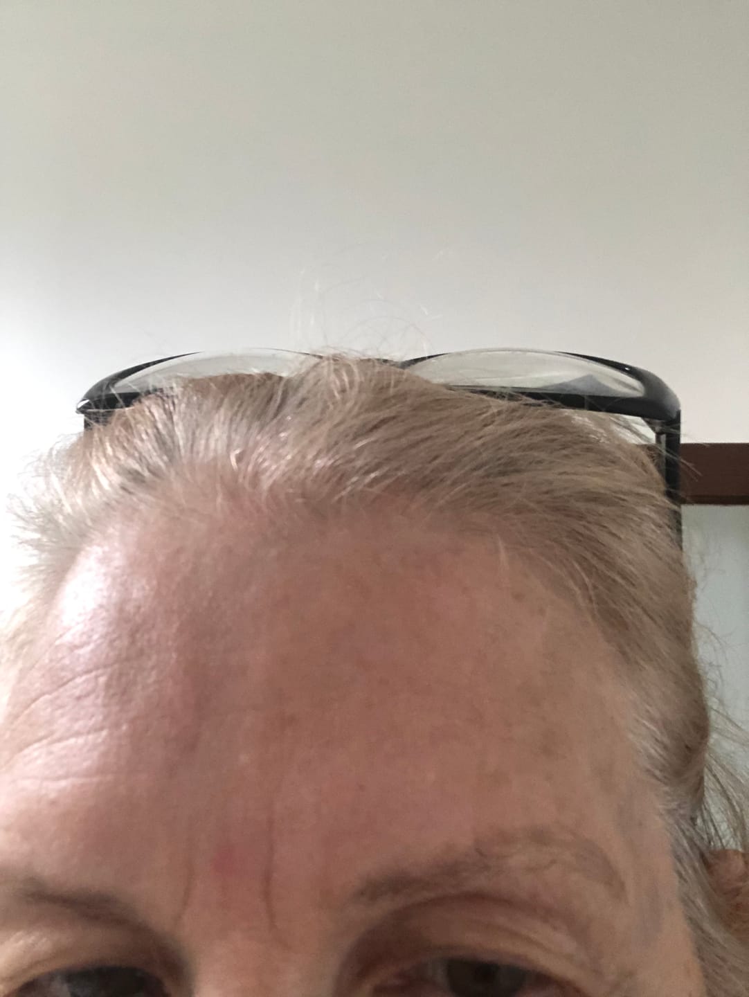 Customer photo review of NEW & IMPROVED LASH SERUM