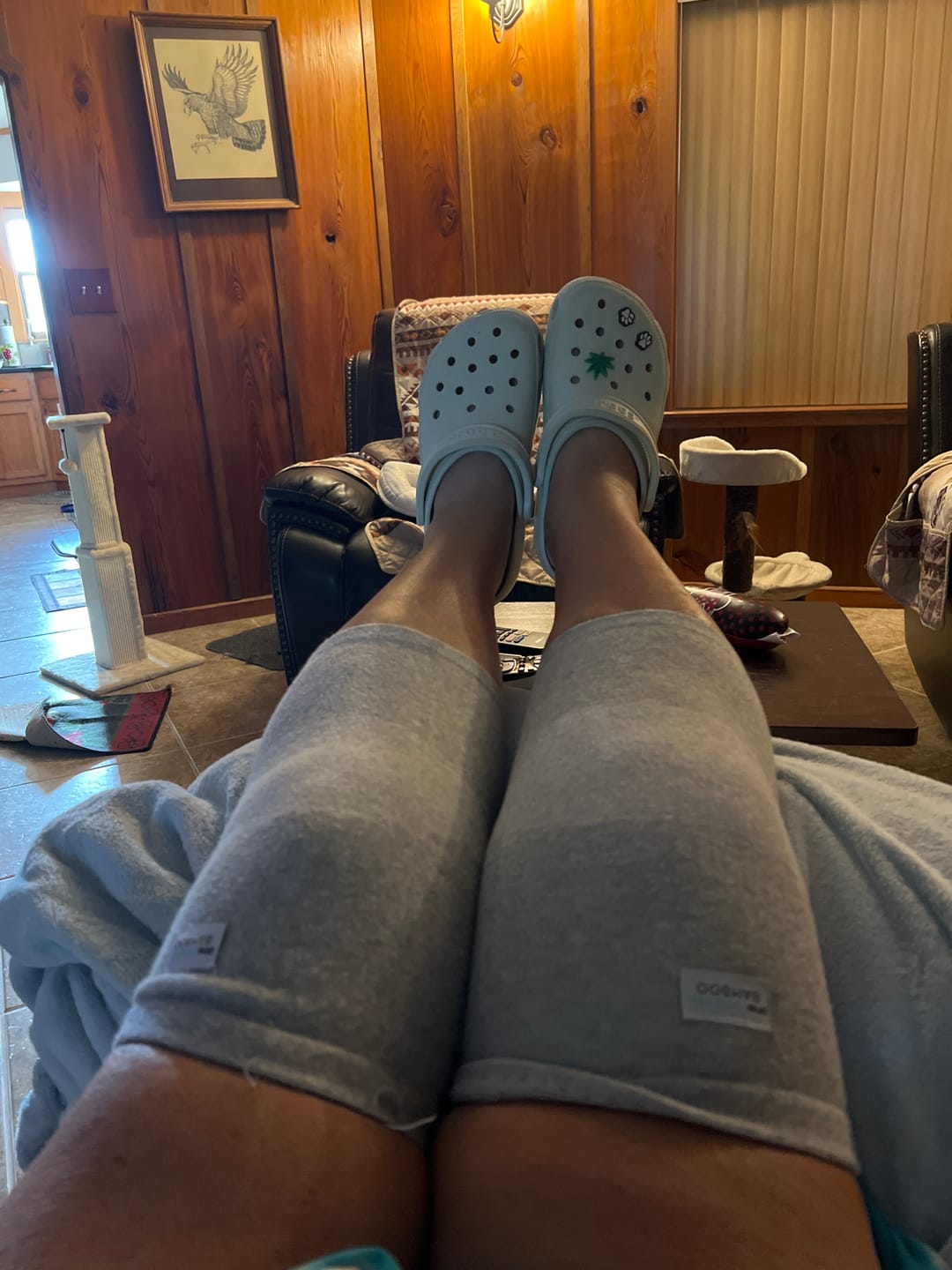 Customer photo review of Premium Bamboo Knee Sleeve (Single)