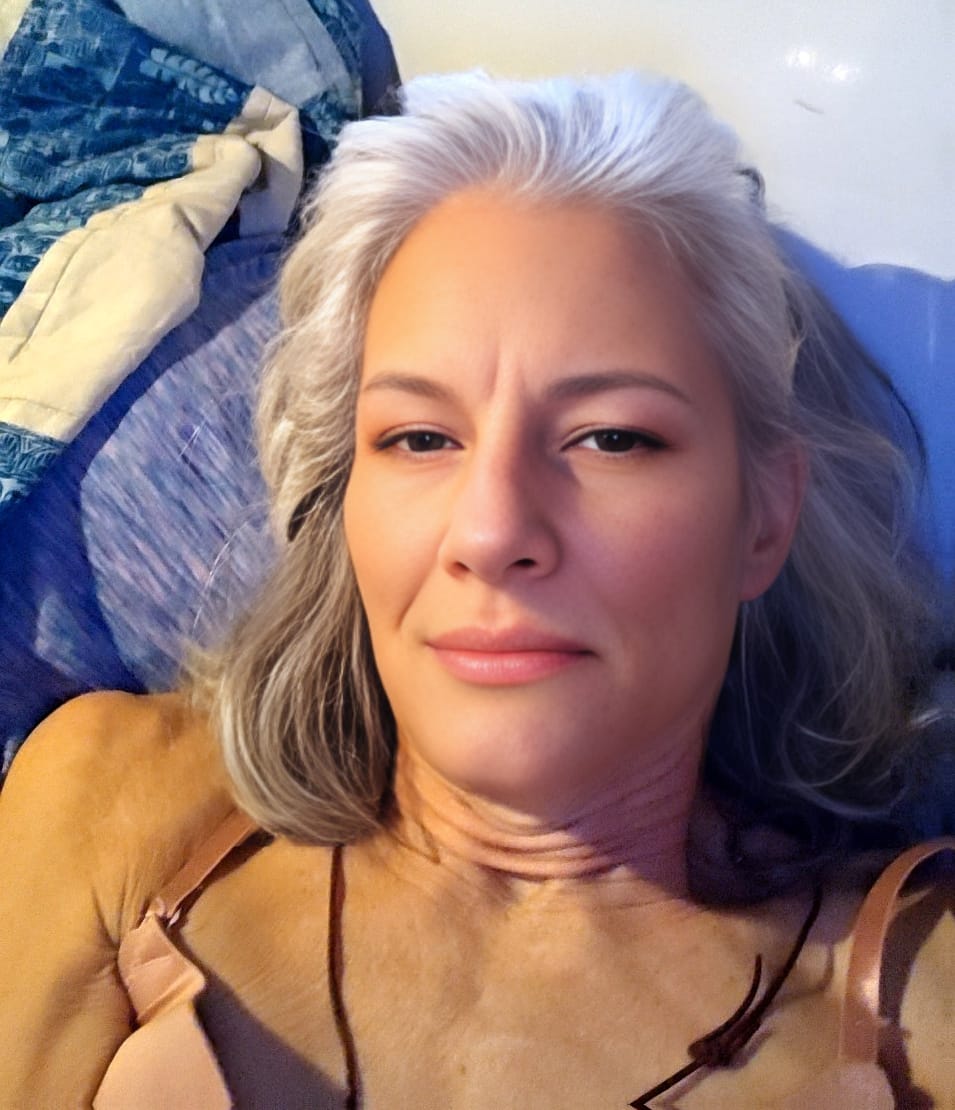 Customer photo review of 3 Month Supply - Seranova Micro Infusion System