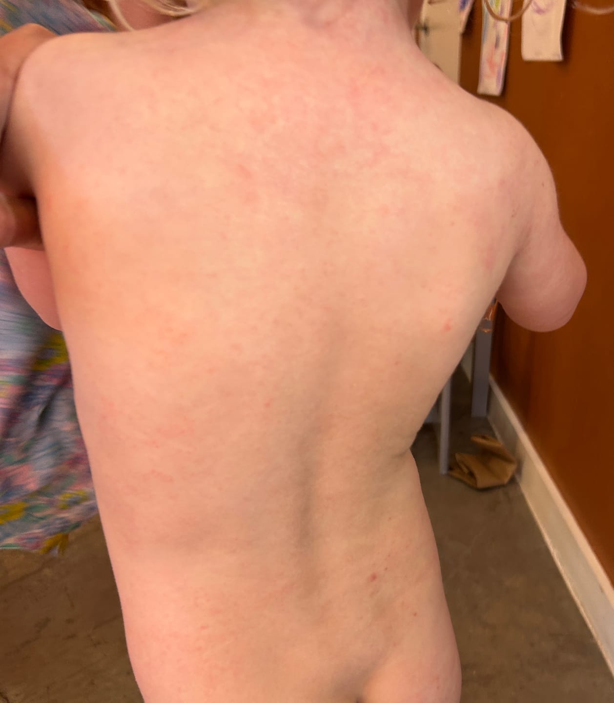 Customer photo review of Children’s Gut Rebalance Kit