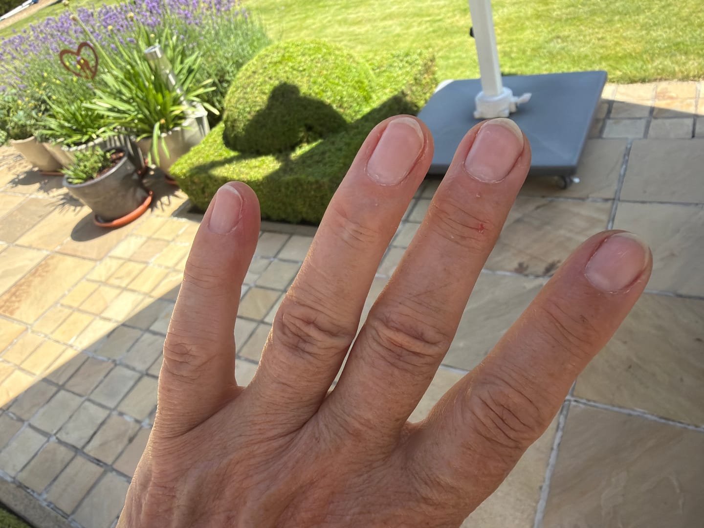Customer photo review of Verzending Verzekering