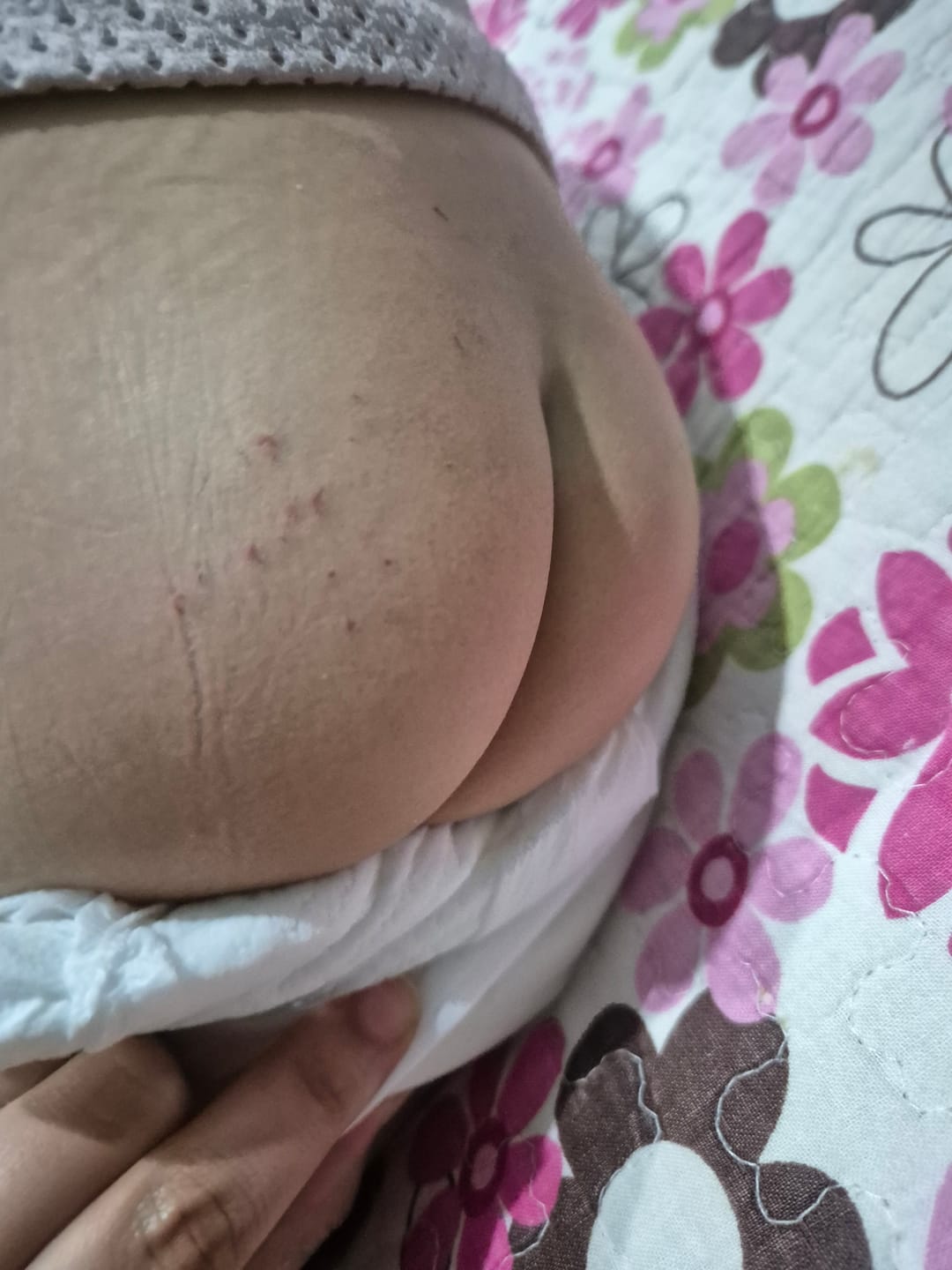 Customer photo review of Pure Diaper