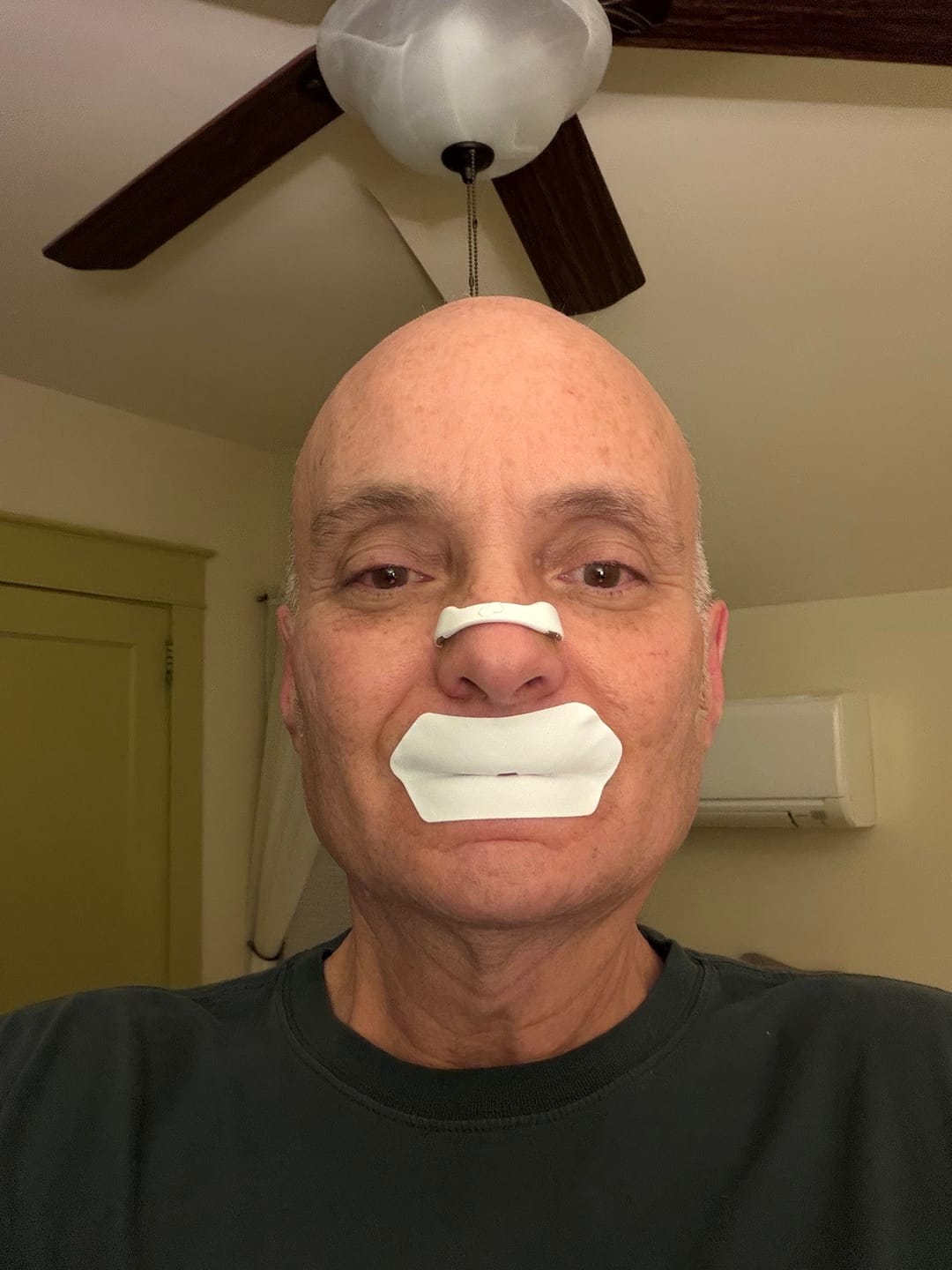 Customer photo review of Intake Mouth Tape