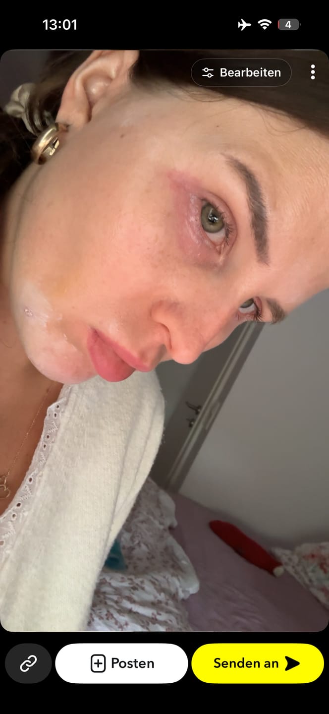 Customer photo review of LASHCOCA!NE - Wimpernserum