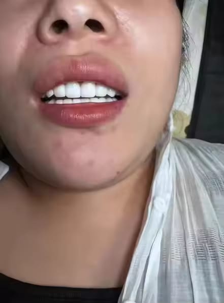 Customer photo review of SparkSmile - V34 (серум за избелване)