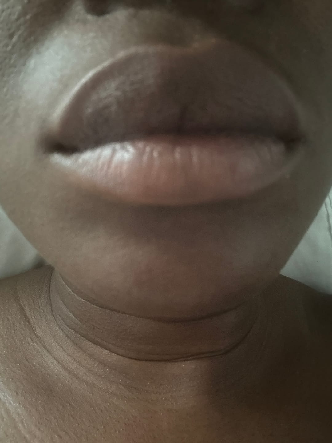 Customer photo review of Lips Lightening Cream For Men and Women (Results in 5 Days or Less)
