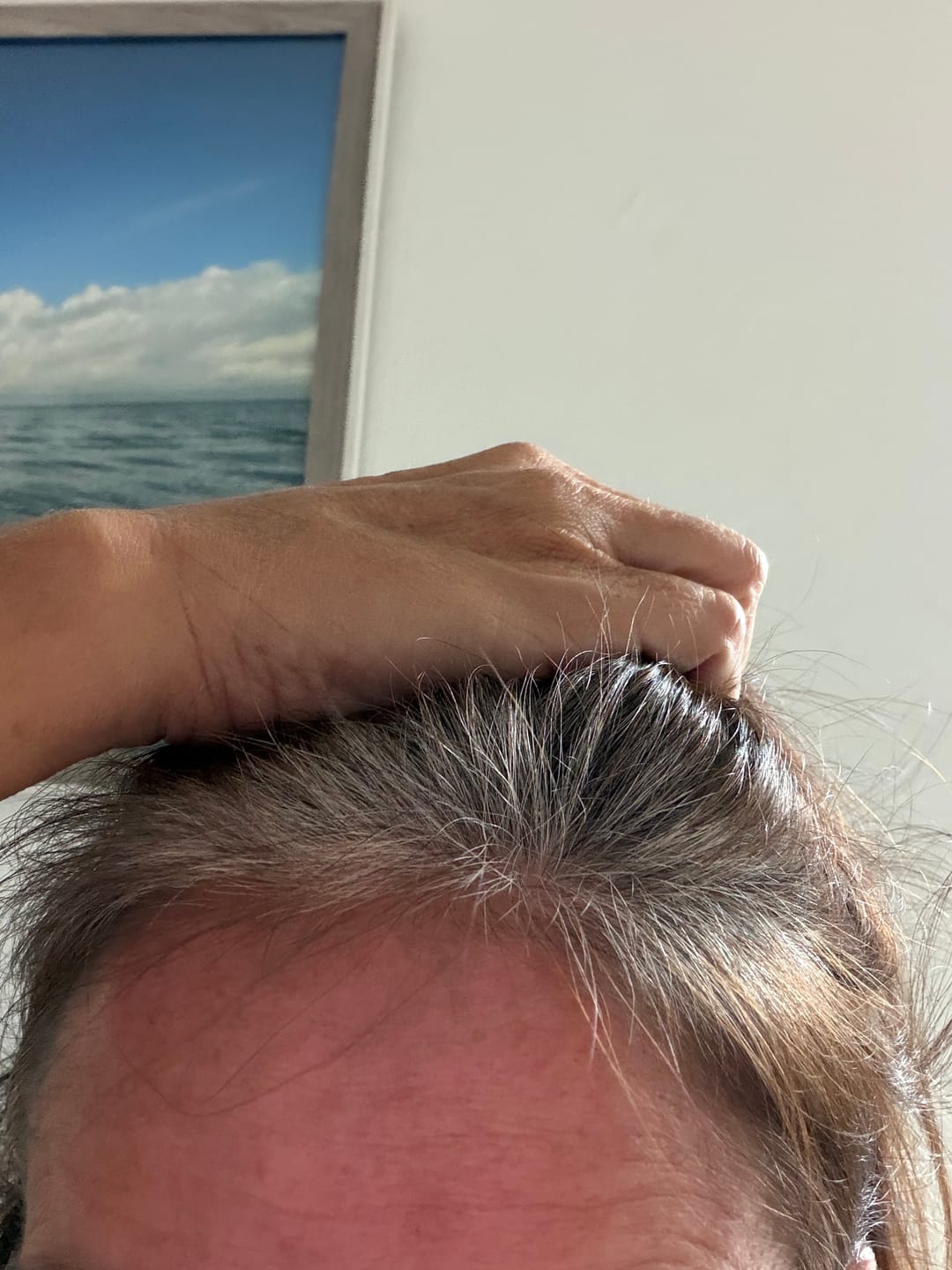 Customer photo review of VITAFOAM ™ Hair Growth Formula