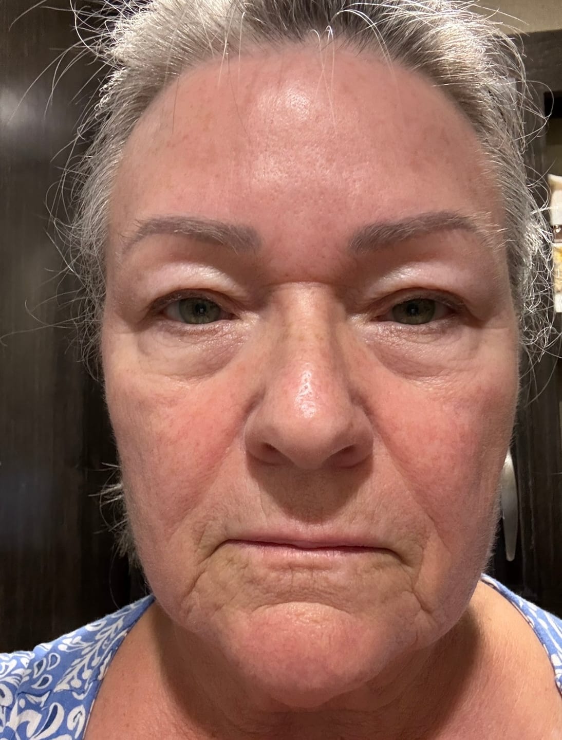 Customer photo review of Deep Collagen Cream