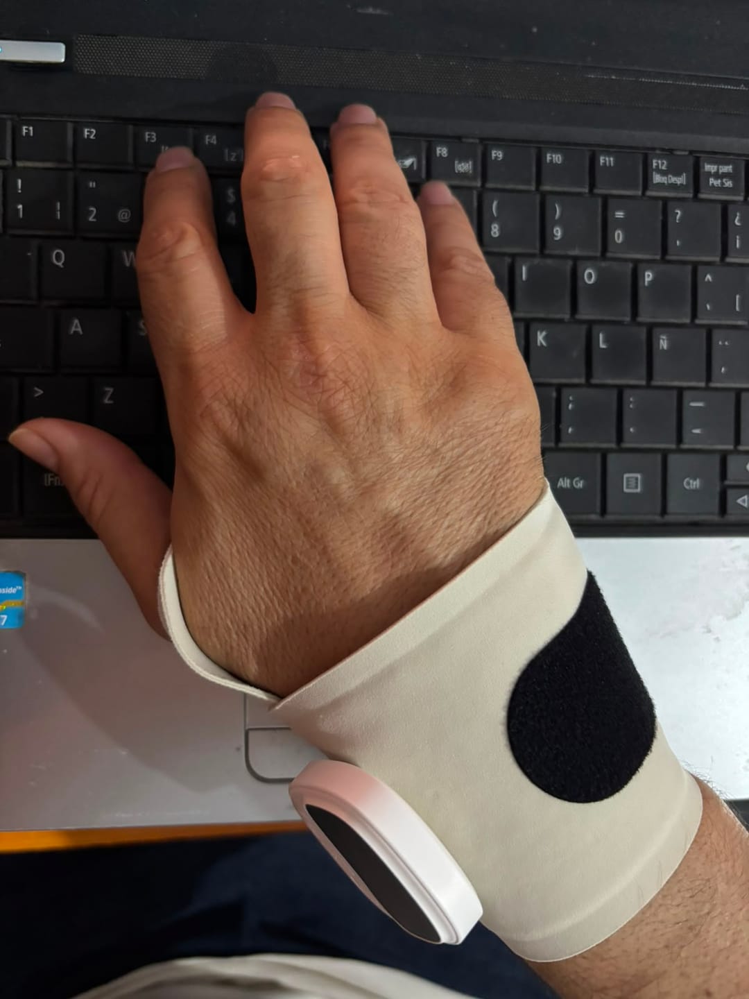 Customer photo review of Muñequera Terapéutica para Alivio de Mano