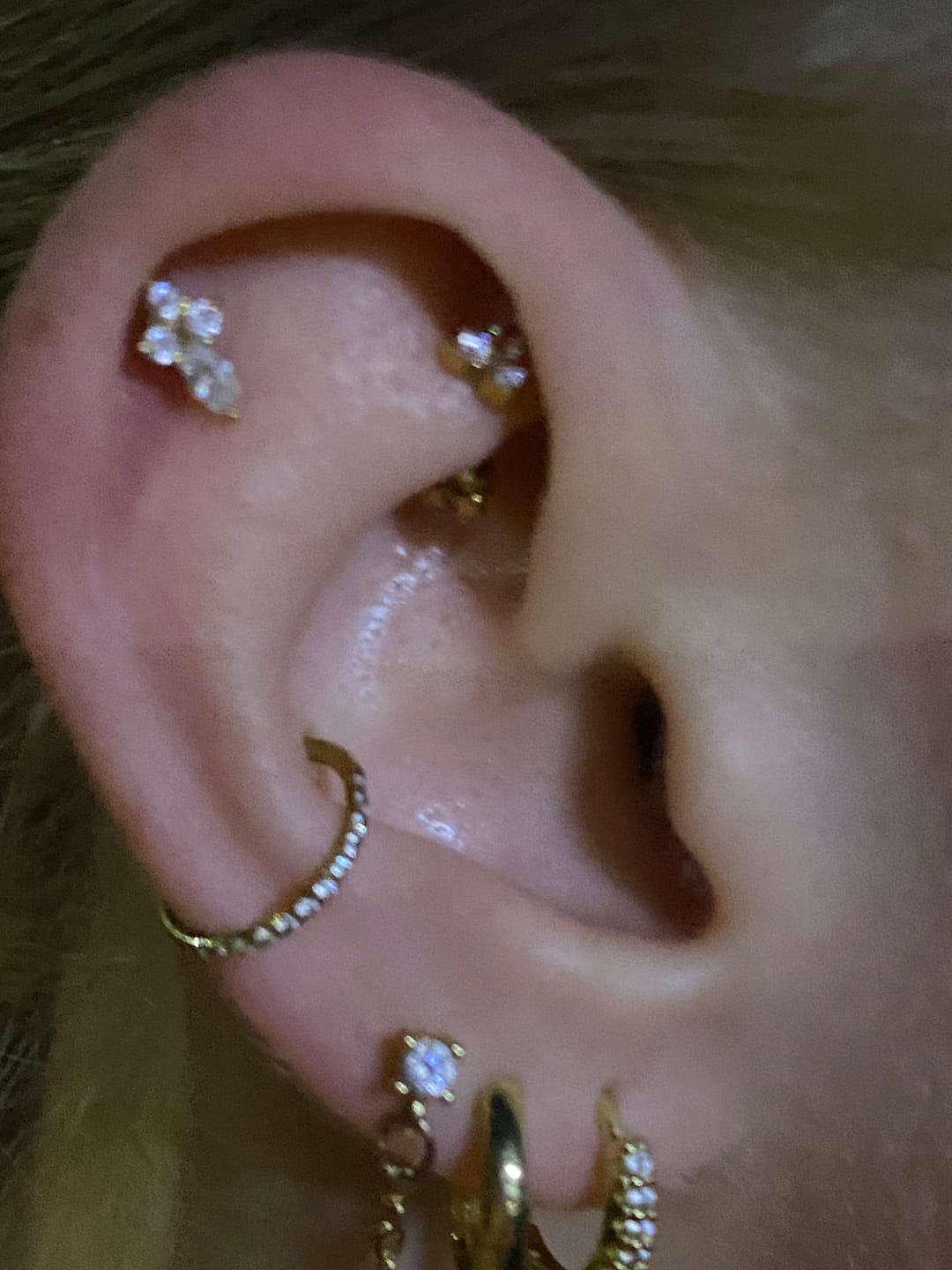 Customer photo review of Hi-Life Lilly Rook Piercing - Titan