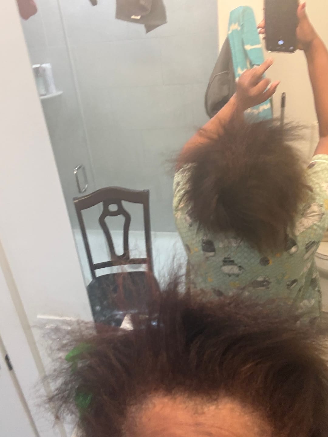 Customer photo review of COMPLETE HAIR RESTORATION & GROWTH SYSTEM