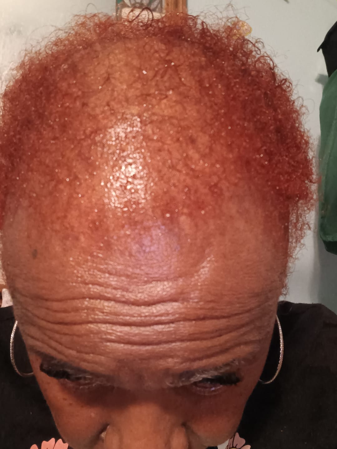 Customer photo review of BALM- Stimulating Scalp and Hair Balm