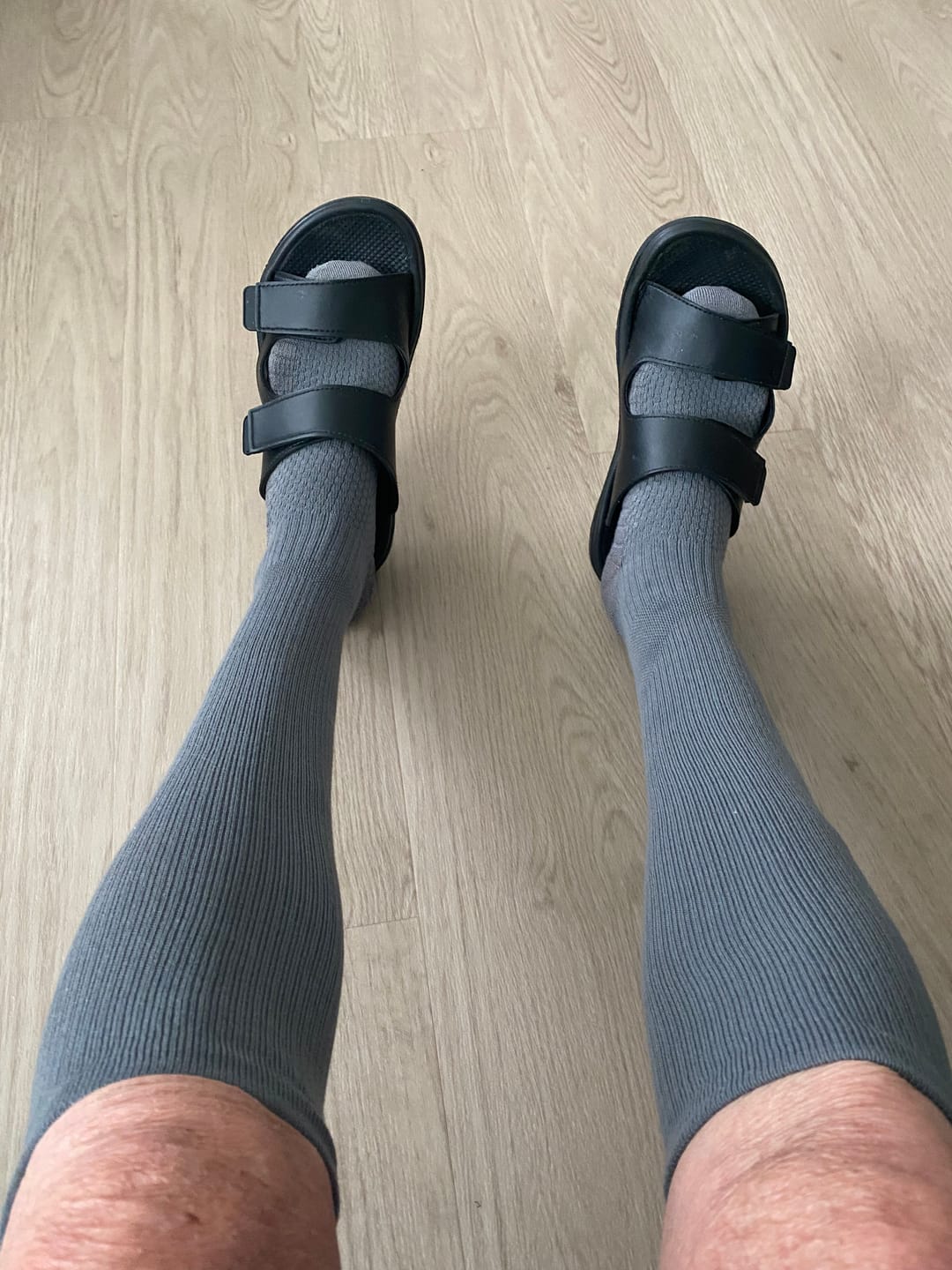 Customer photo review of Støttestrømper