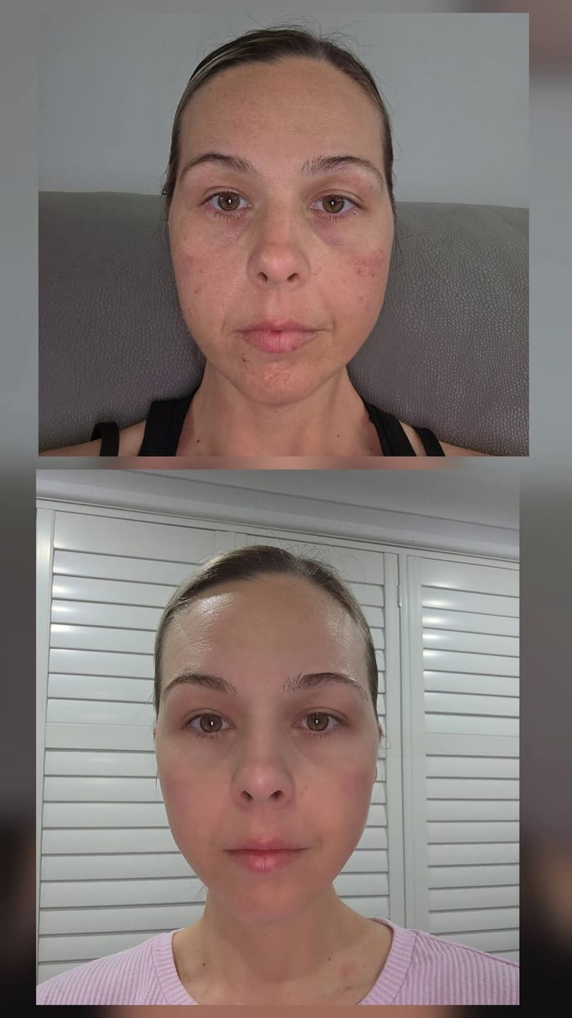 Customer photo review of FIRMING SERUM