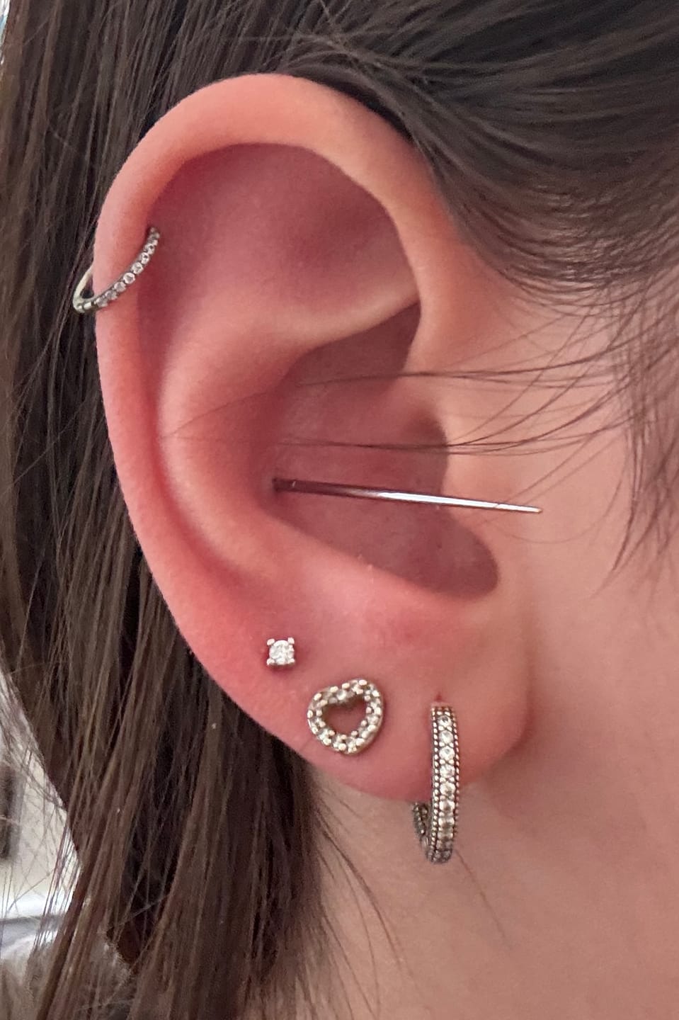 Customer photo review of Flatback Insertion Taper