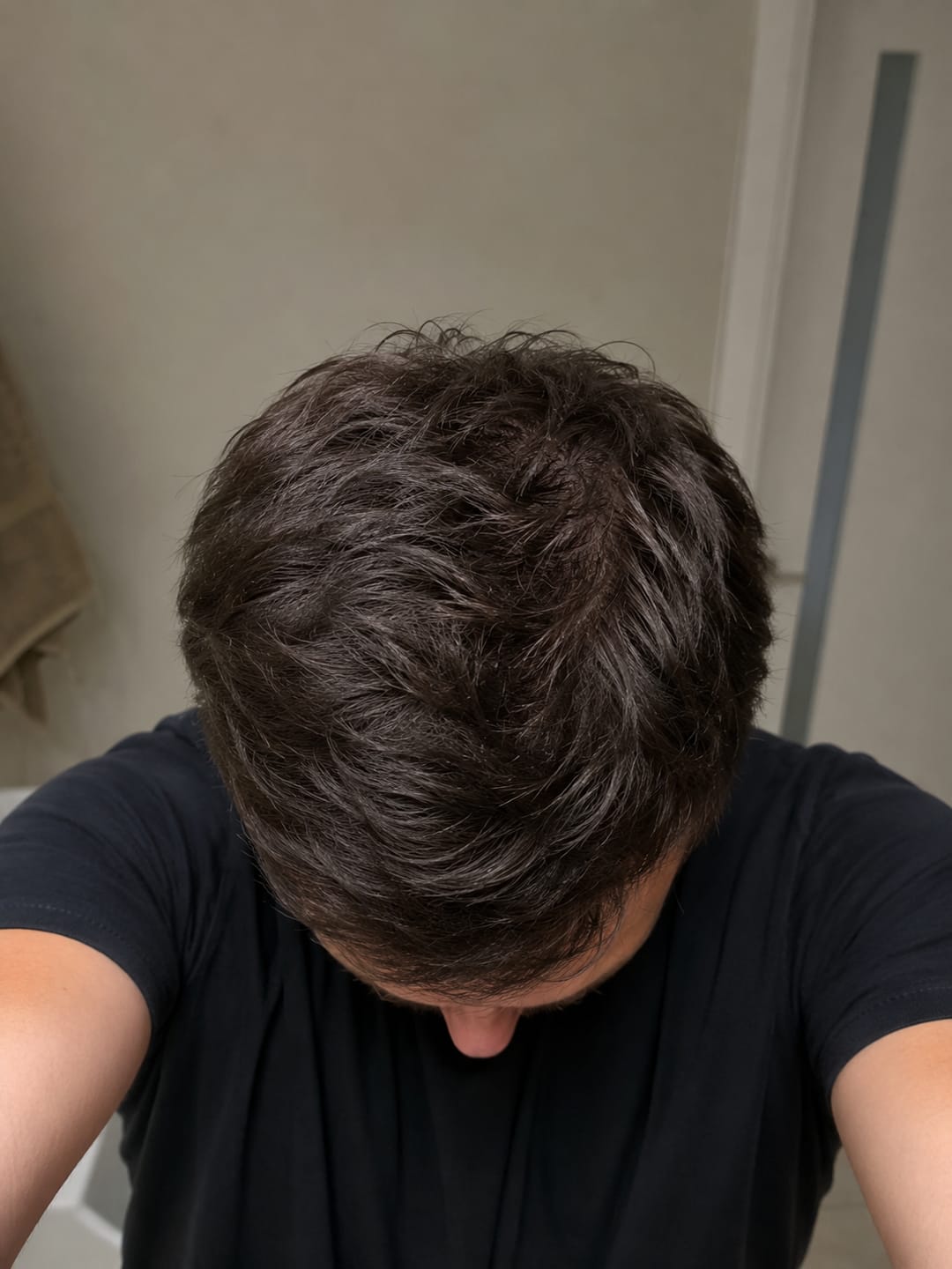 Customer photo review of Kéralux Scalp Brush