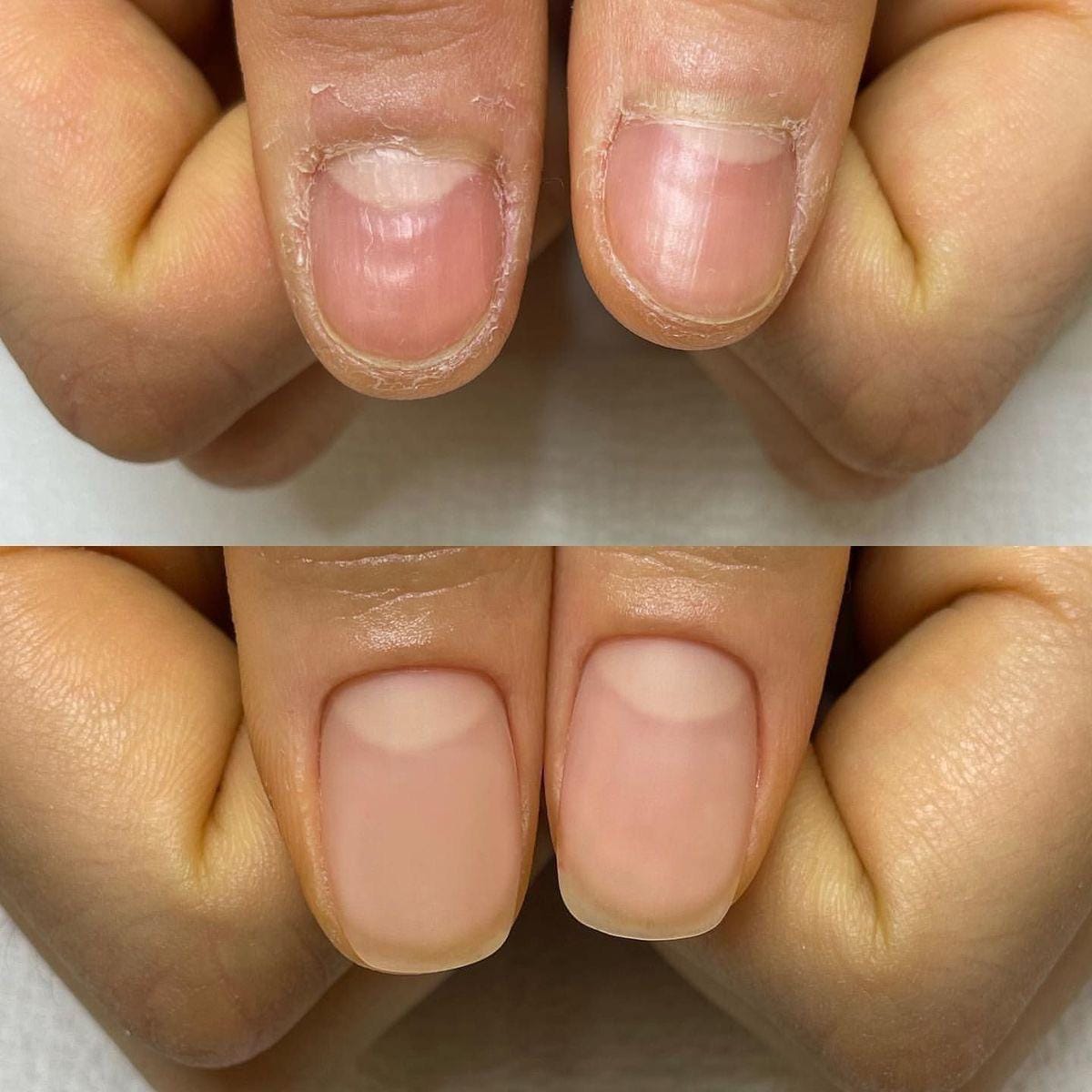 Customer photo review of 30-Day Hand Recovery System