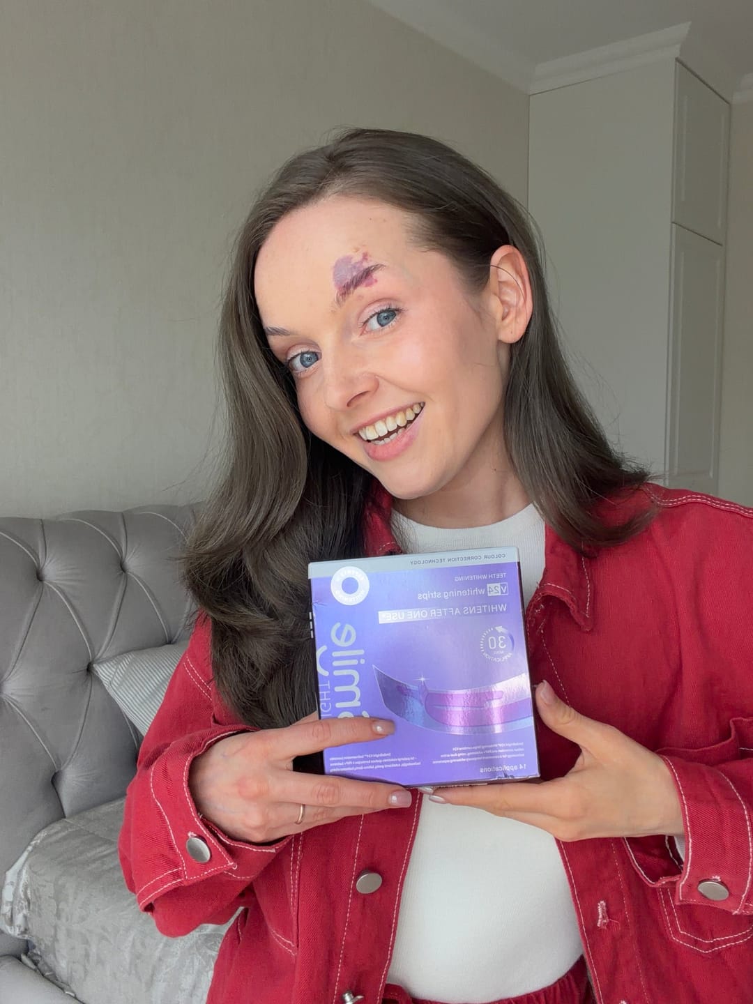 Customer photo review of V24 Violetinės Dantų Balinimo Juostelės