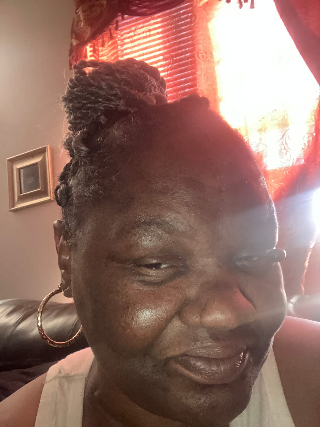 Customer photo review of Scalp Stimulator- 3 Month Supply