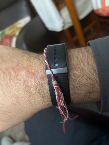 Customer photo review of Aura Band Pro 2.0