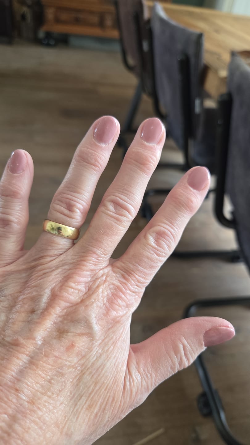 Customer photo review of Verwijder Wattenbollen (100 stuks)