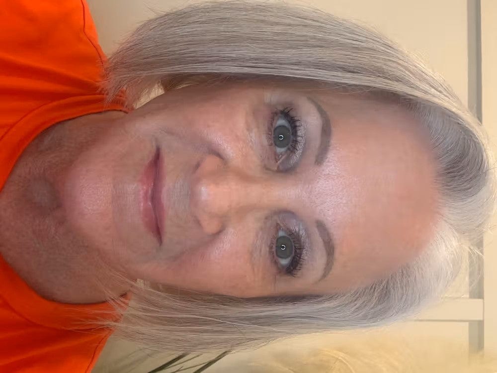 Customer photo review of ELYVIA Micro-Infusion System™