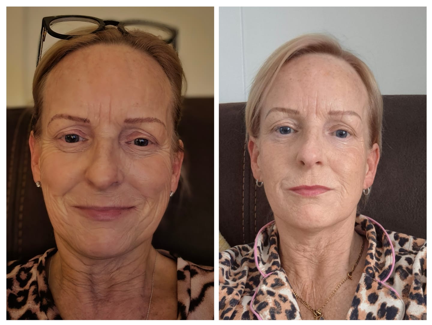 Customer photo review of ZO ANTI-AGEING PROGRAM