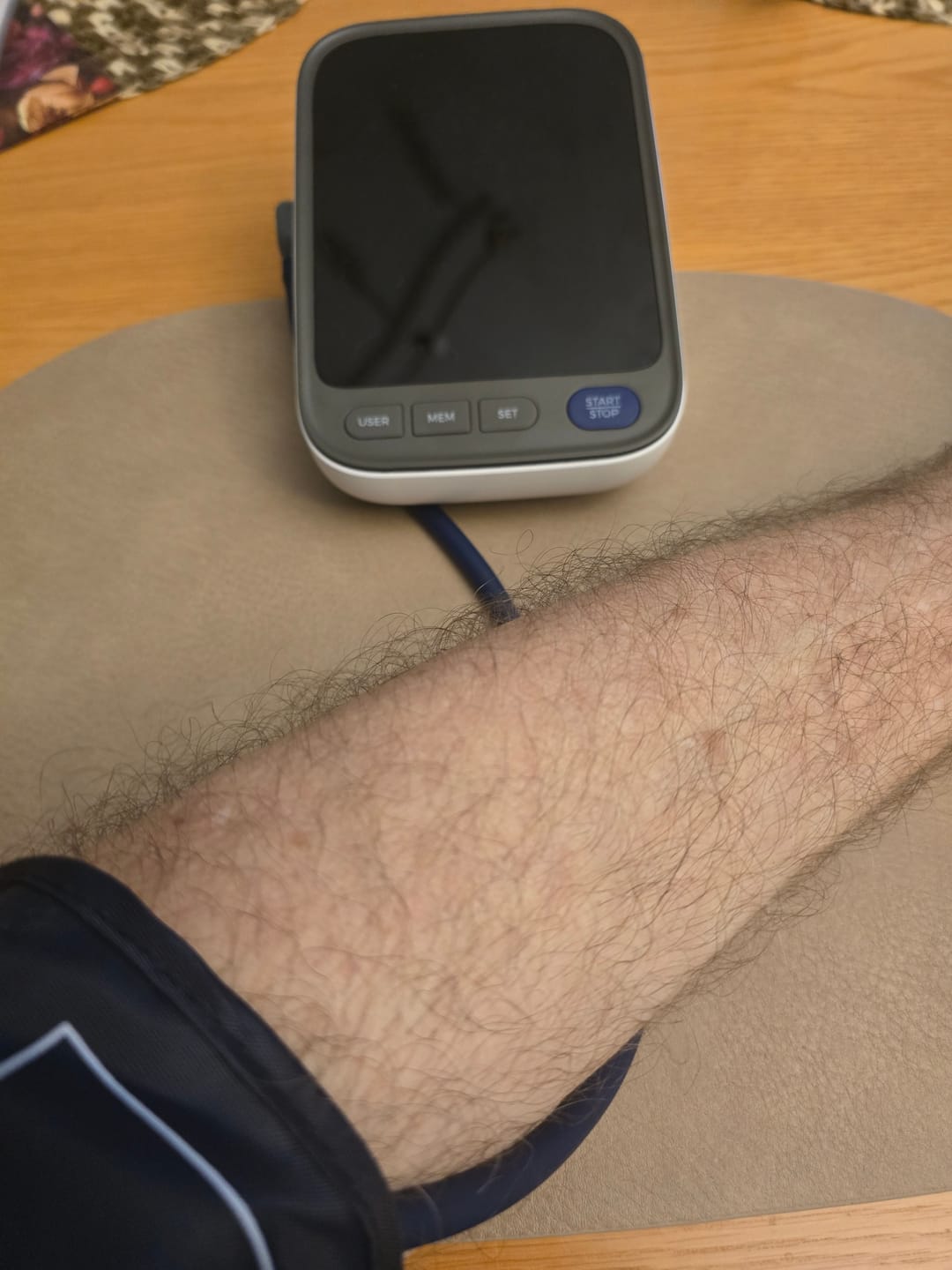 Customer photo review of Blutdruckmessgerät V8 Ultra – Next-Gen Präzisionssensor für klinisch genaue Messungen
