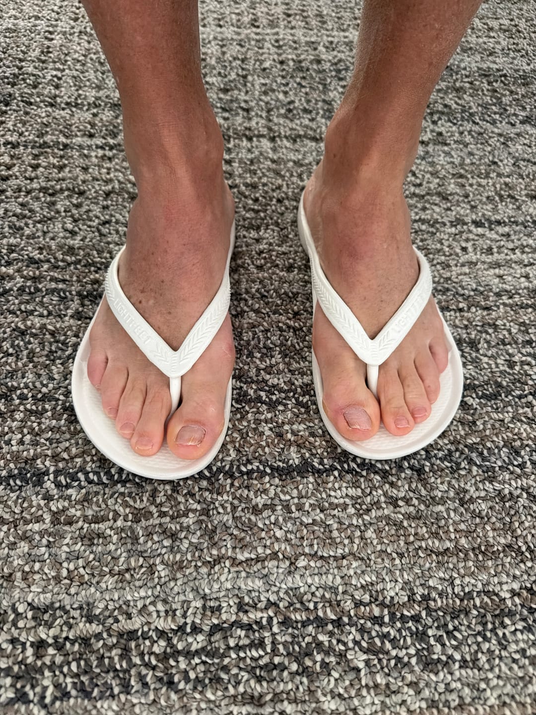 Customer photo review of White - Arch Support Flip Flops