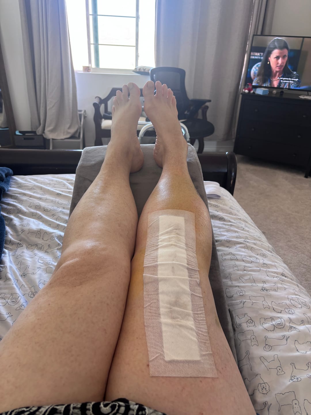 Customer photo review of Full Spectrum 3300mg CBG Cream - Available in Unscented and Cooling