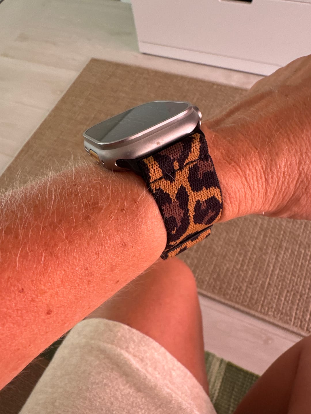 Customer photo review of Roxane Nylon Loop Band
