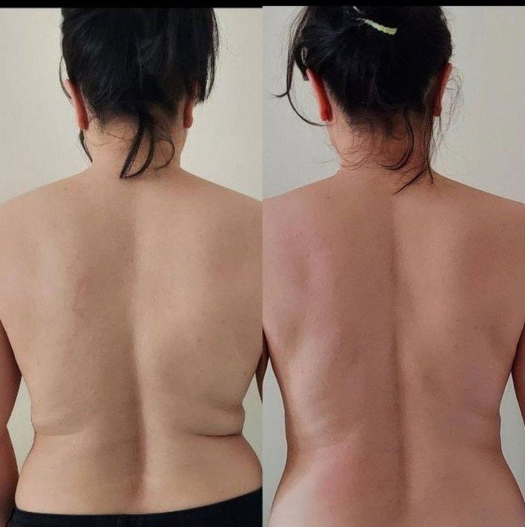 Customer photo review of Drainant Lymphatique BelGlow — Complexe Lympha-4