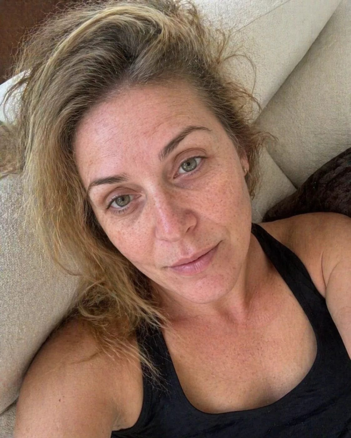 Customer photo review of ELYVIA Micro-Infusion System™
