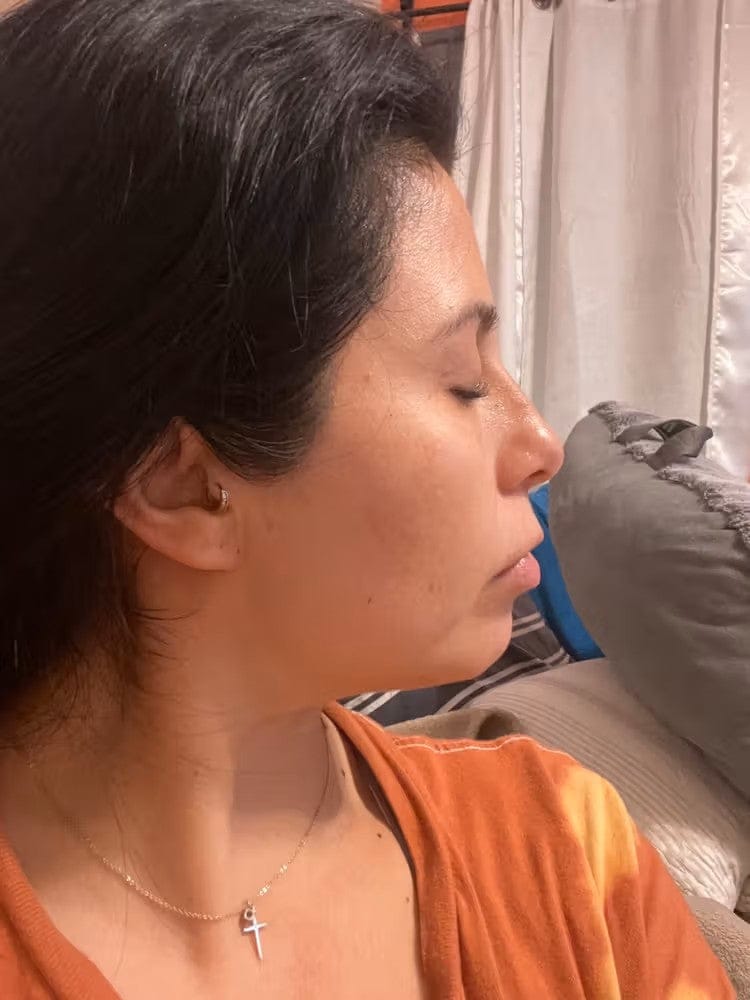 Customer photo review of ELYVIA Micro-Infusion System™