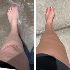 Customer photo review of Drainant Lymphatique BelGlow — Complexe Lympha-4