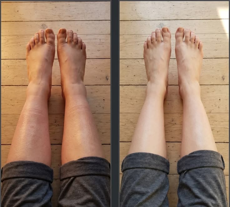 Customer photo review of Drainant Lymphatique BelGlow — Complexe Lympha-4
