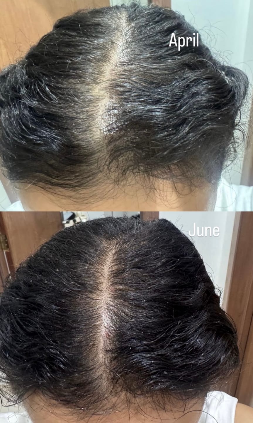 Customer photo review of VITAFOAM ™ Hair Growth Formula