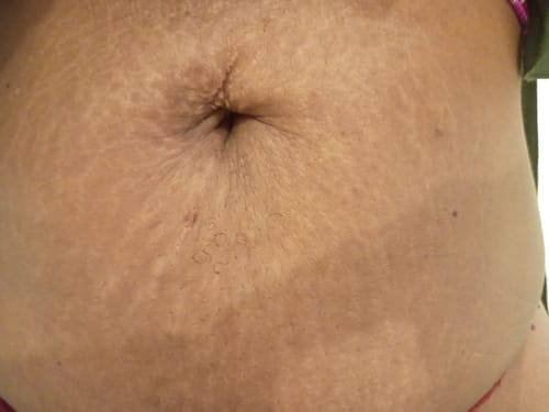 Customer photo review of Crème Raffermissante