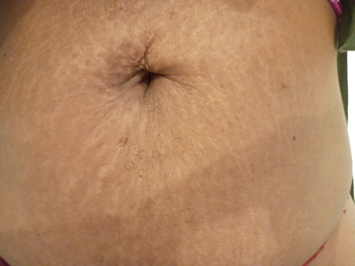 Customer photo review of Crème Raffermissante