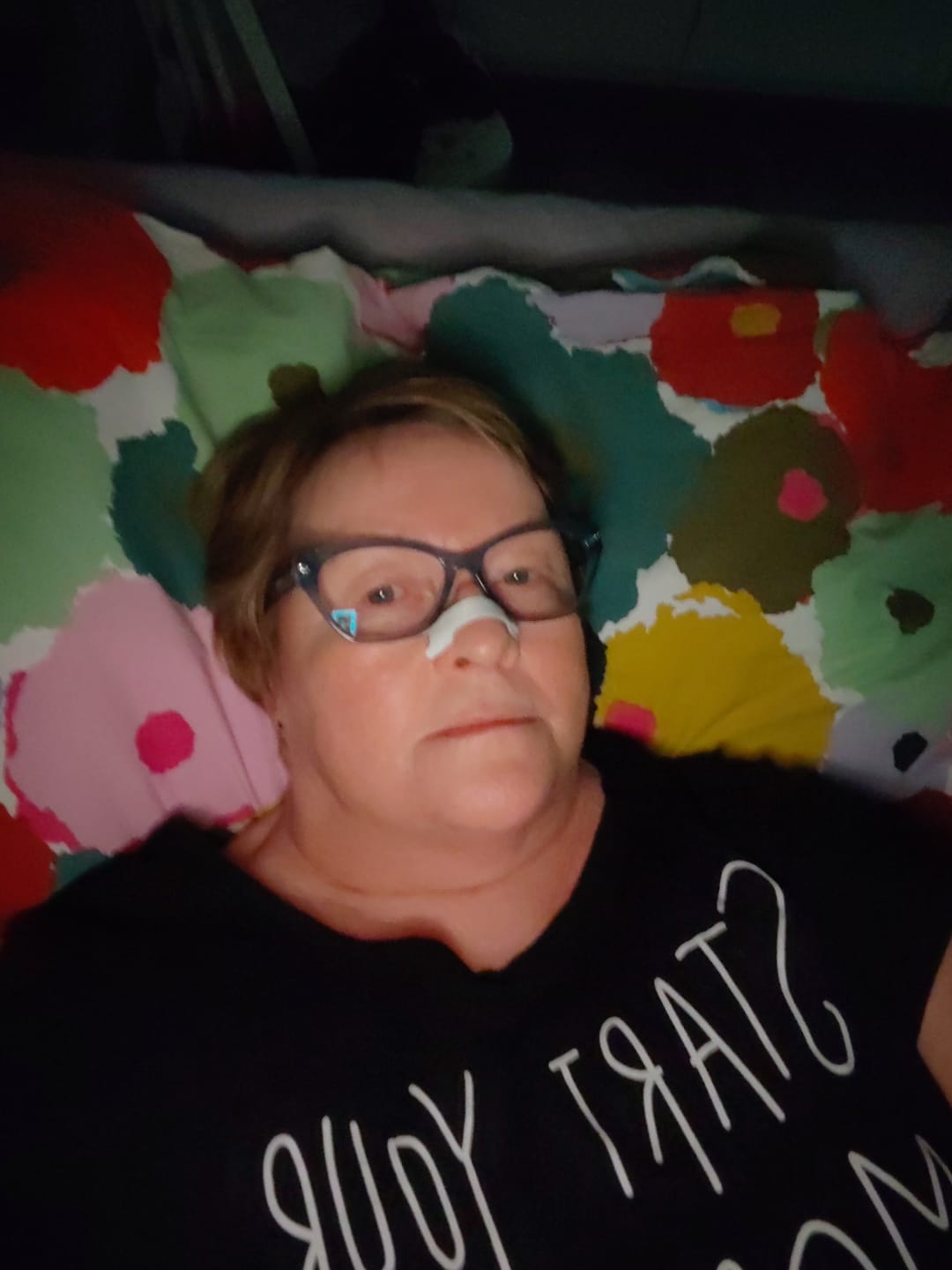 Customer photo review of Nuku Sleep Nasal Strips