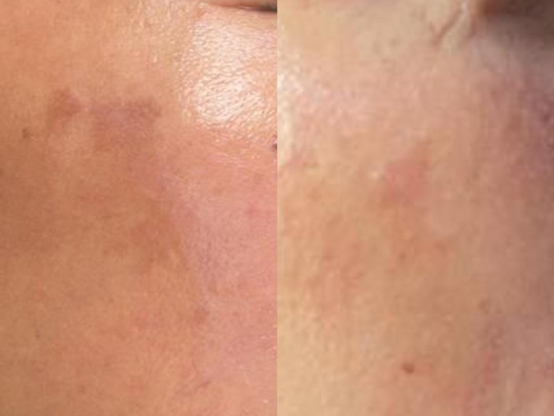 Customer photo review of Marine Collagen Cream