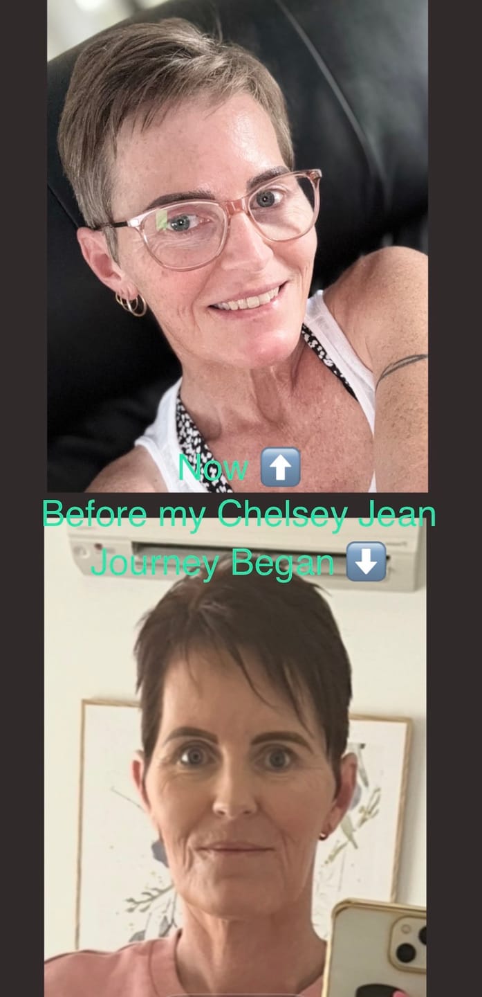 Customer photo review of Lymphatic Special Bundle