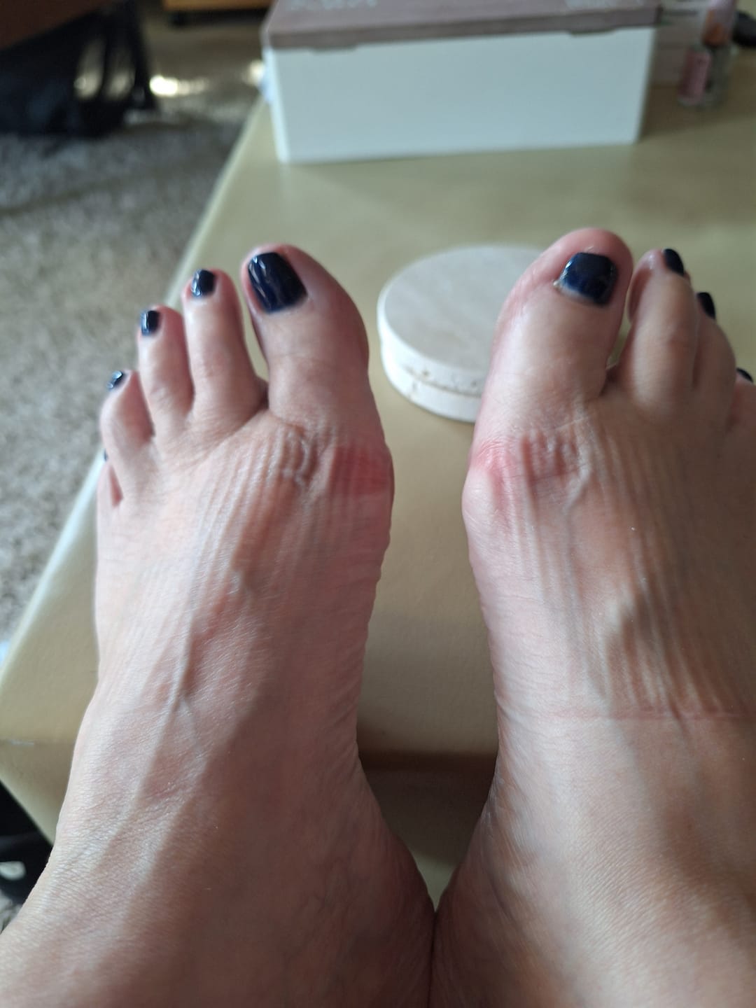 Customer photo review of HappyFlops Botanics