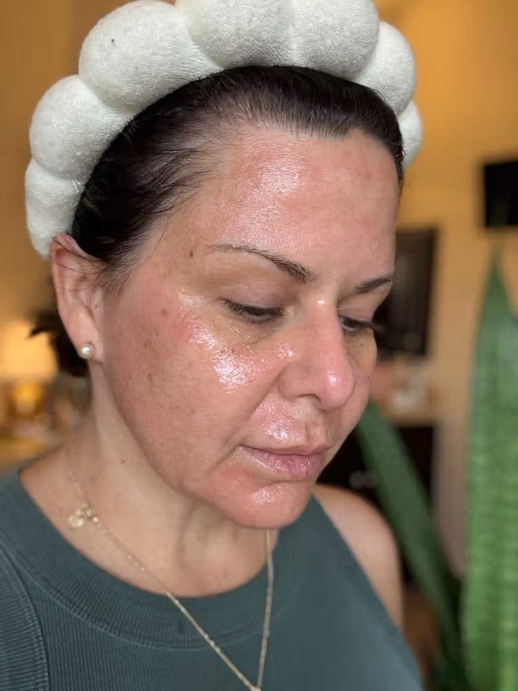 Customer photo review of ELYVIA Micro-Infusion System™