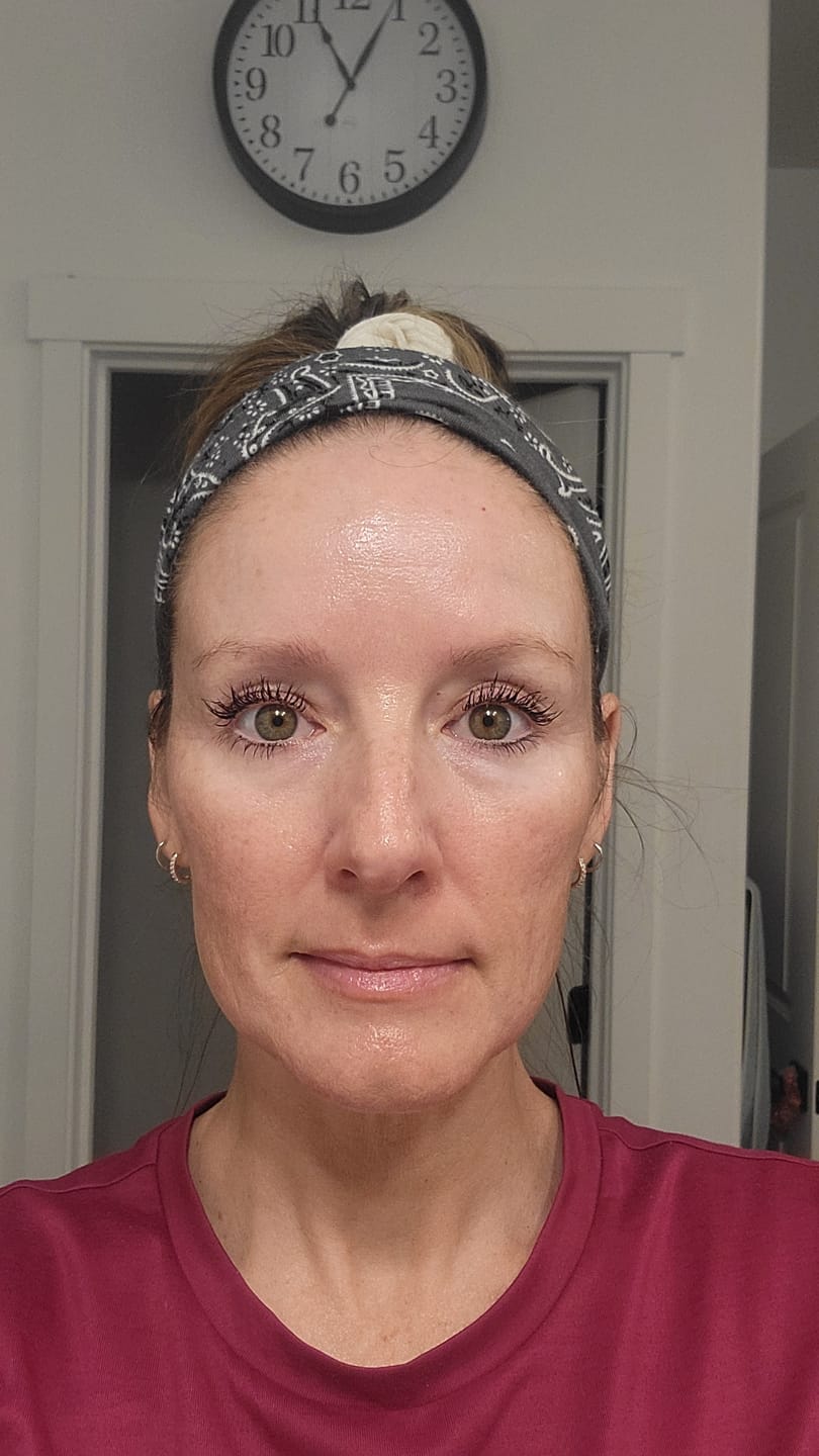 Customer photo review of 1 Month Supply - Deep Collagen Cream
