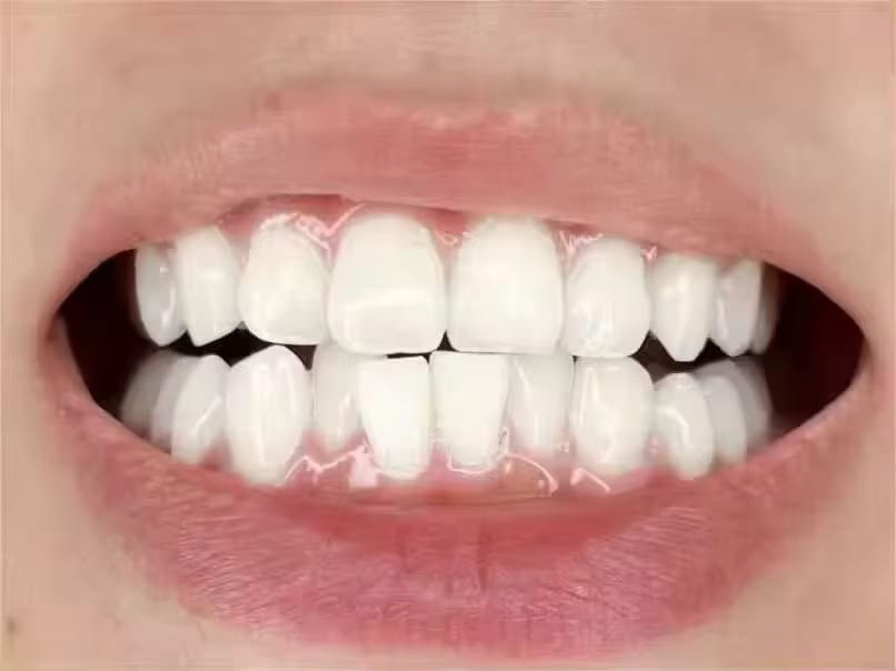 Customer photo review of PAP+ Powder - Whitening Booster
