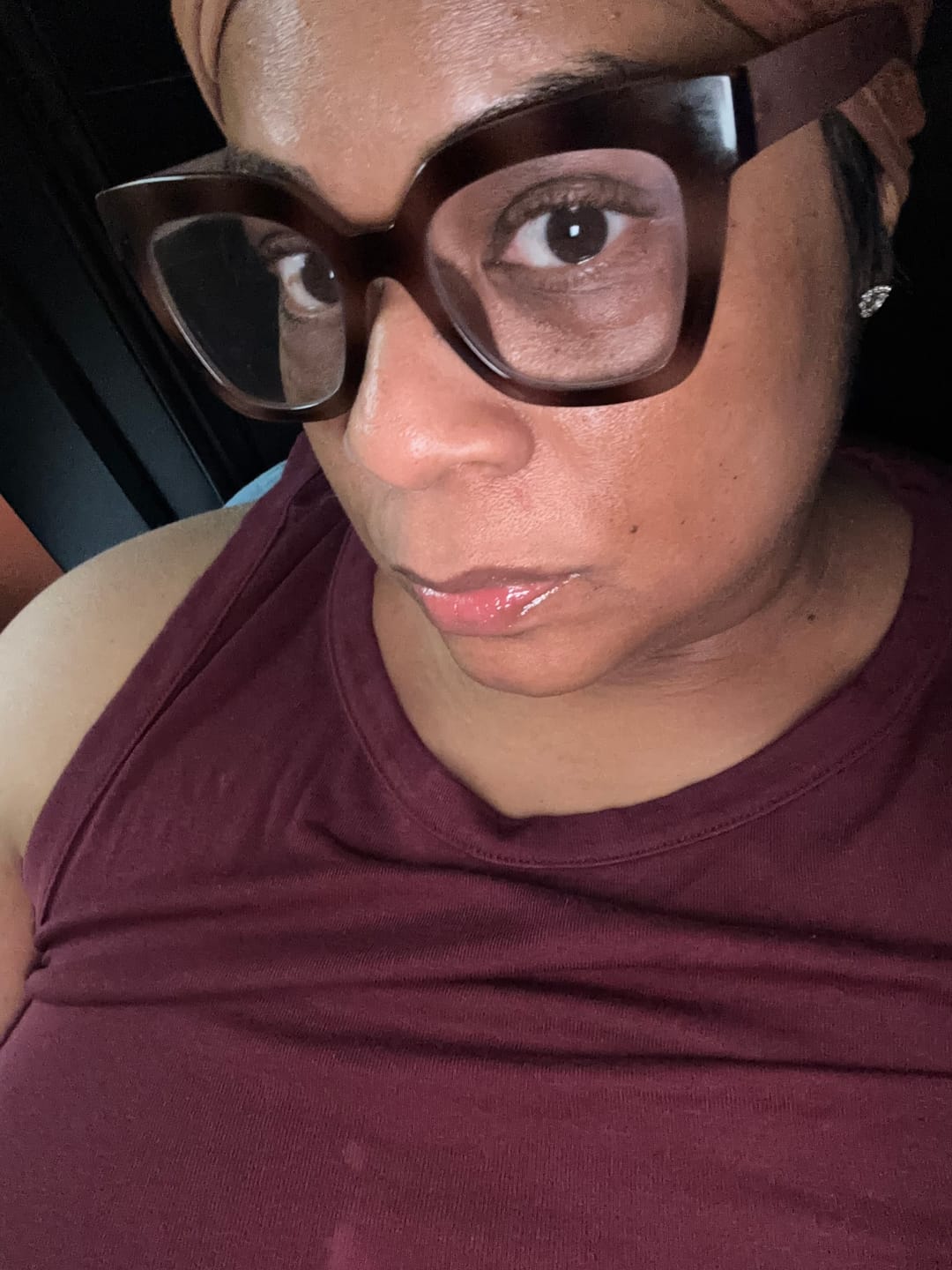 Customer photo review of Soursop Vitamin C Serum