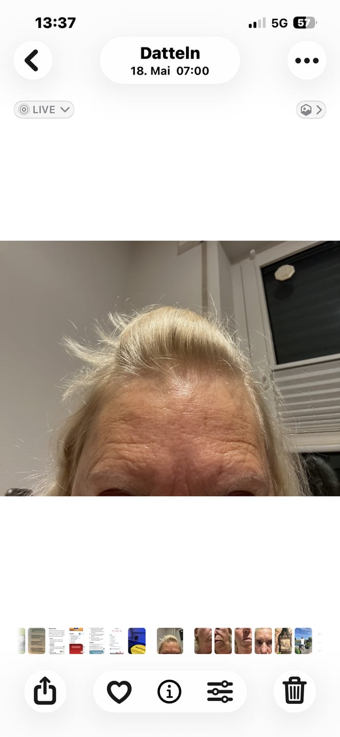 Customer photo review of Natural Botulin Serum