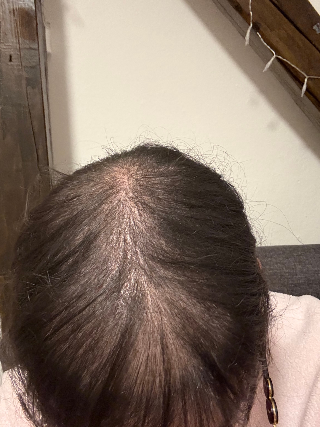 Real Growplex customer scalp